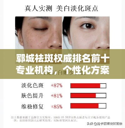 郓城祛斑权威排名前十专业机构，个性化方案任你选