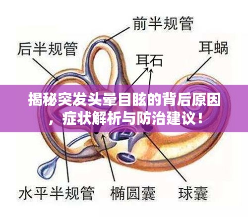 揭秘突发头晕目眩的背后原因，症状解析与防治建议！