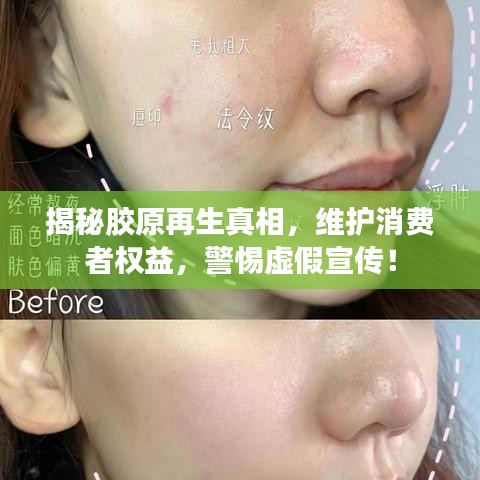 揭秘胶原再生真相，维护消费者权益，警惕虚假宣传！